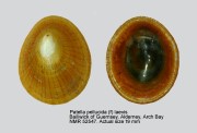 Patella pellucida